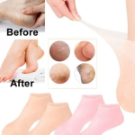 Anti Crack Socks